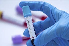 12 nuevos contagios para el Meta; ya van 1.305